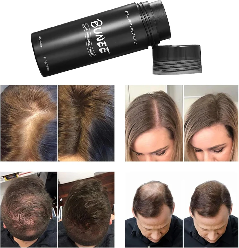 Description of Image